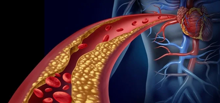 Reduce bone deterioration

