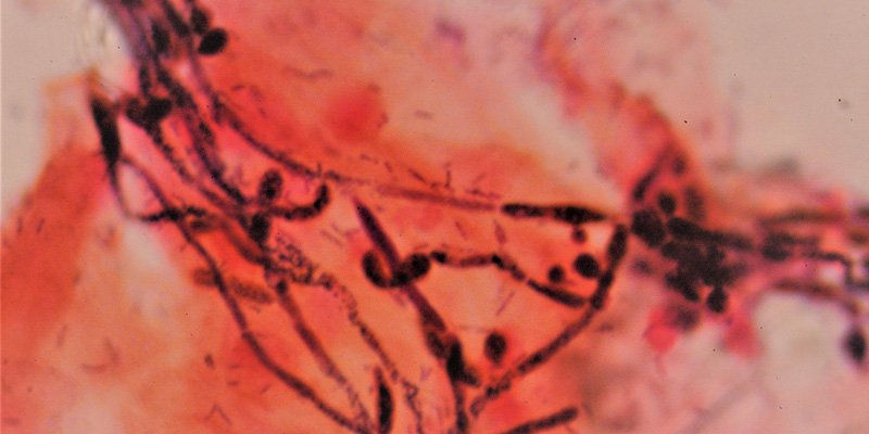 Reduction of Vaginal Infections
